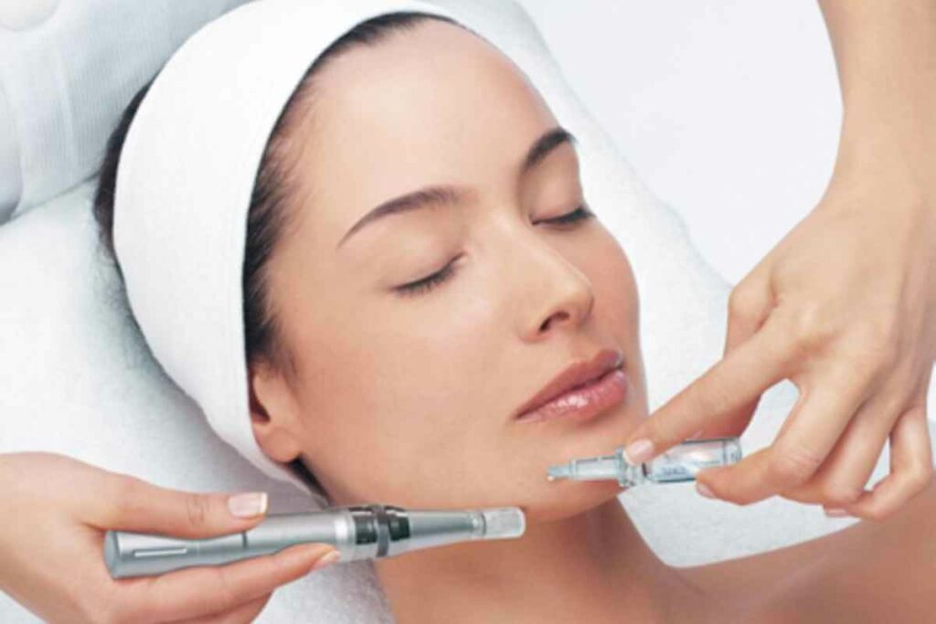 Microneedling (Mezoterapia) - Kozmetické štúdio Comfort - Žilina
